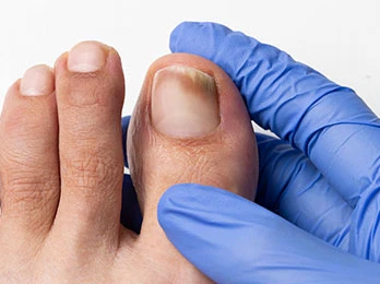 Podiatrist in the Toms River, NJ 08757 area